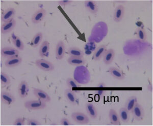Avian Malaria Red Blood Cell