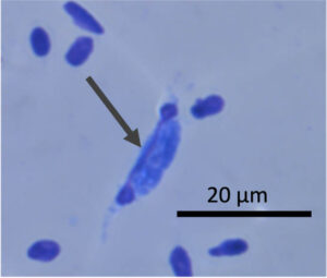 Avian malaria in a white blood cell
