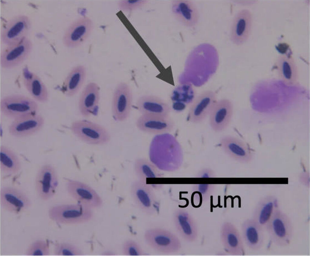 Avian Malaria