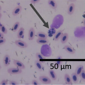 Avian Malaria
